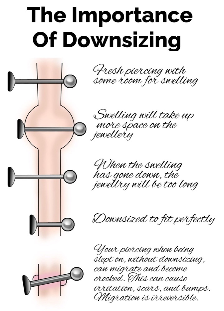 The importance of downsizing: a fresh piercing has room for swelling, swelling takes up space on the jewelry, once swelling goes down the jewelry is too long, downsized jewelry fits perfectly, and without downsizing jewelry can migrate and become crooked