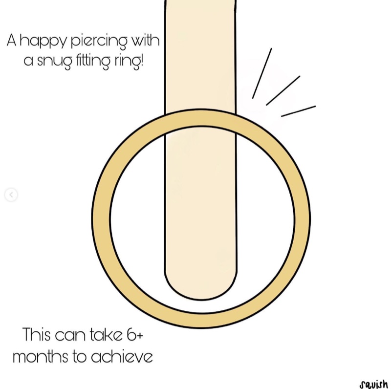 A happy piercing with a snug fitting ring — this can take 6+ months to achieve